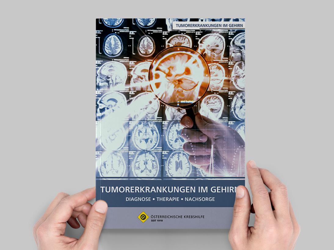 Tumor­erkrankungen im Gehirn